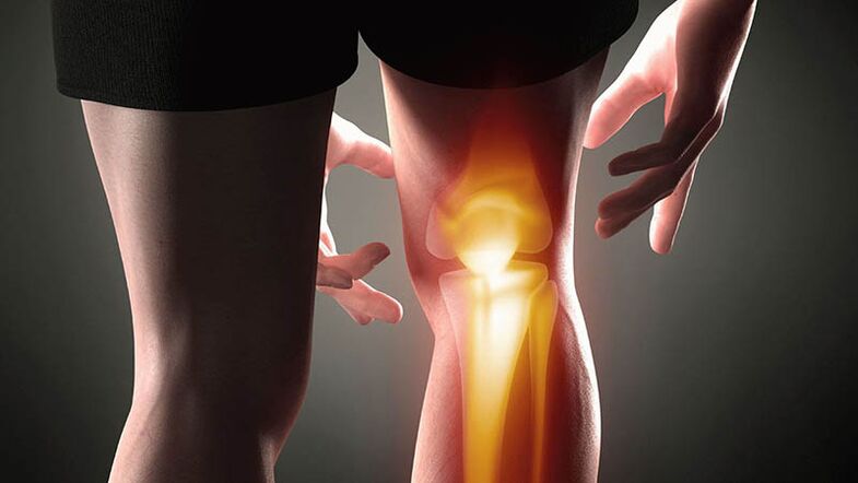 Arthrosis vum Knéi Gelenk