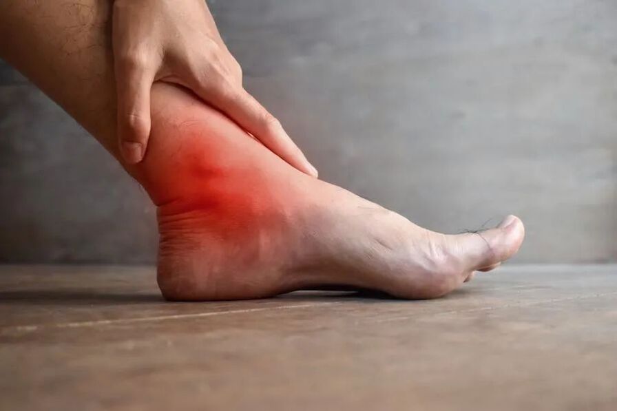 Arthrosis vum Knöchelgelenk